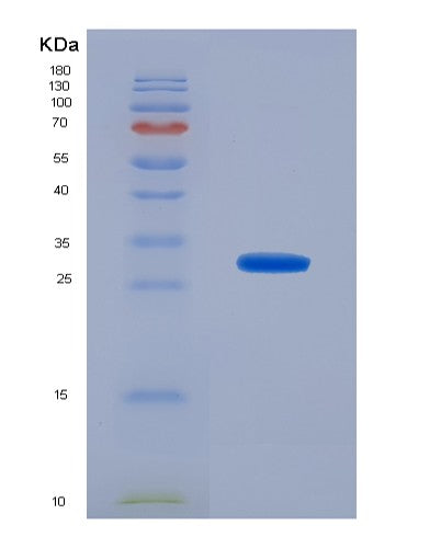 Human ACSF2 (Medium-Chain Acyl-Coa Ligase Acsf2, Mitochondrial) - Recombinant Protein