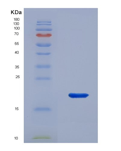 Human CNRIP1 (Cb1 Cannabinoid Receptor-Interacting Protein 1) - Recombinant Protein