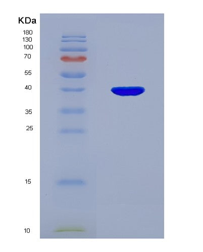 Human OTUB1 (Ubiquitin Thioesterase Otub1) - Recombinant Protein
