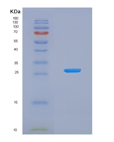 Human BMF (Bcl-2-Modifying Factor) - Recombinant Protein