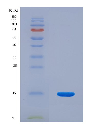 Human TAFA4 (Chemokine-Like Protein Tafa-4) - Recombinant Protein