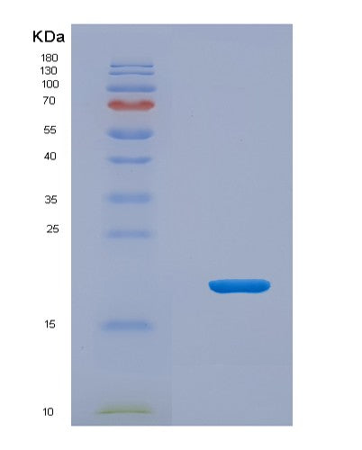 Human MCEE (Methylmalonyl-Coa Epimerase, Mitochondrial) - Recombinant Protein