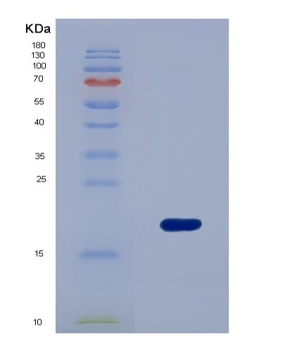 Human AMELX (Amelogenin, X Isoform) - Recombinant Protein