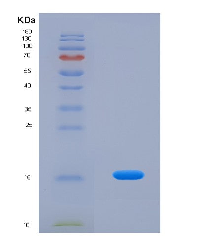 Human MYCBP (C-Myc-Binding Protein) - Recombinant Protein