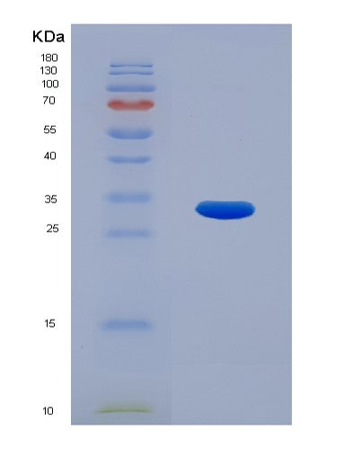 Human CNN2 (Calponin-2) - Recombinant Protein