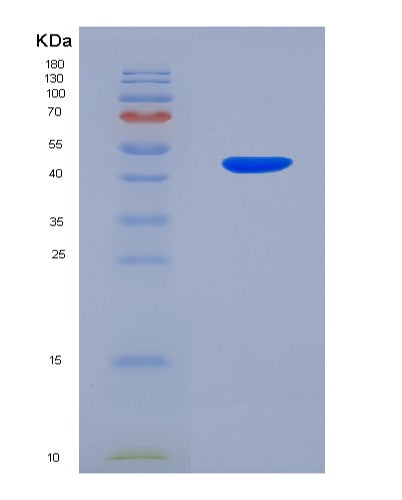 Human PAFAH2 (Platelet-Activating Factor Acetylhydrolase 2, Cytoplasmic) - Recombinant Protein