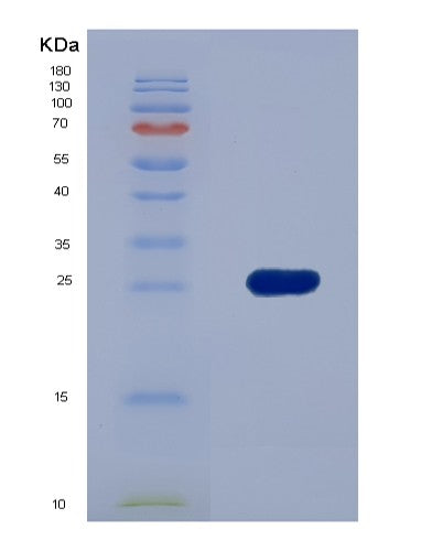 Human PLIN2 (Perilipin-2) - Recombinant Protein