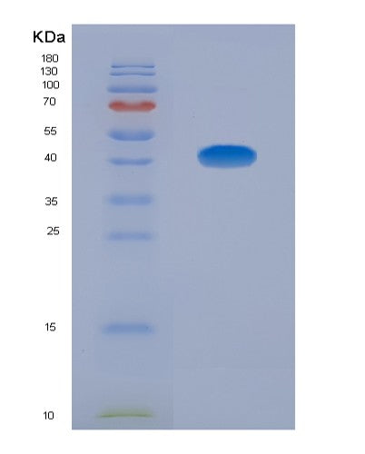 Human CCL13 (C-C Motif Chemokine 13) - Recombinant Protein