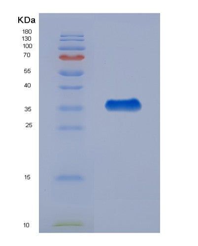 Human PHB2 (Prohibitin-2) - Recombinant Protein
