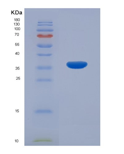 Human MGLL (Monoglyceride Lipase) - Recombinant Protein