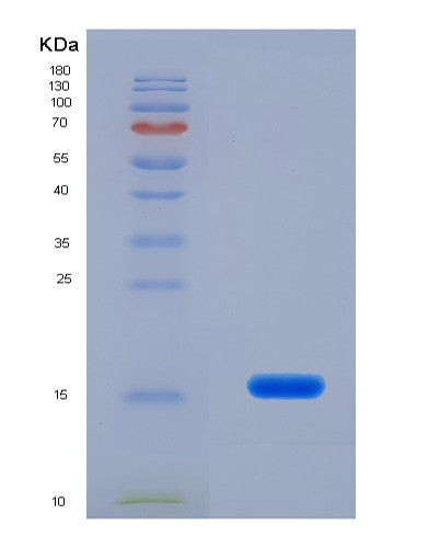 Human RARRES2 (Retinoic Acid Receptor Responder Protein 2) - Recombinant Protein
