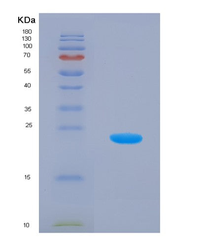 Mouse Park7 (Parkinson Disease Protein 7 Homolog) - Recombinant Protein