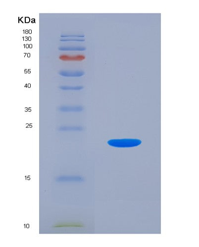 Human HSPB9 (Heat Shock Protein Beta-9) - Recombinant Protein