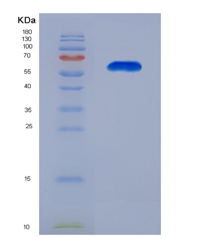 Human ERP44 (Endoplasmic Reticulum Resident Protein 44) - Recombinant Protein