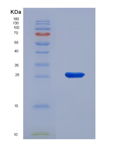Human LXN (Latexin) - Recombinant Protein