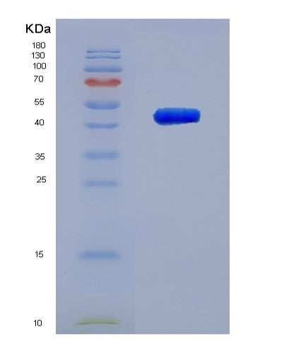 Human VAMP8 (Vesicle-Associated Membrane Protein 8) - Recombinant Protein