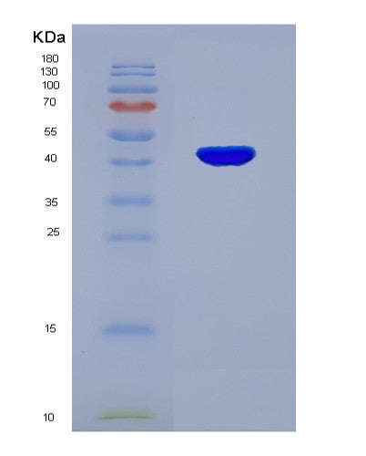 Human ACAT2 (Acetyl-Coa Acetyltransferase, Cytosolic) - Recombinant Protein