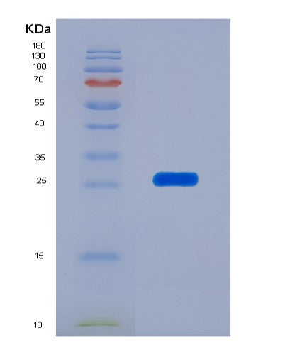 Human ITPA (Inosine Triphosphate Pyrophosphatase) - Recombinant Protein