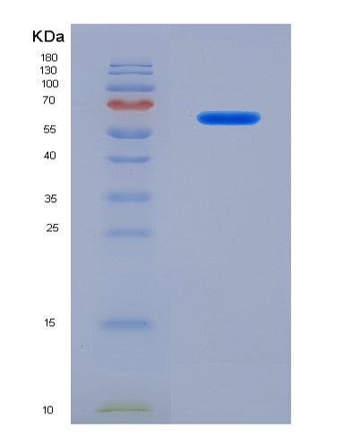 Human CADM1 (Cell Adhesion Molecule 1) - Recombinant Protein