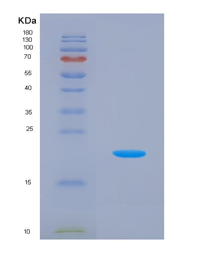 Human MRPL1 (Large Ribosomal Subunit Protein Ul1M) - Recombinant Protein