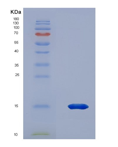 Human PKIB (Camp-Dependent Protein Kinase Inhibitor Beta) - Recombinant Protein