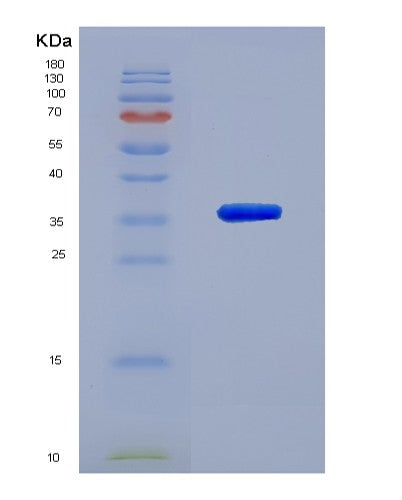 Human TRIM5 (Tripartite Motif-Containing Protein 5) - Recombinant Protein