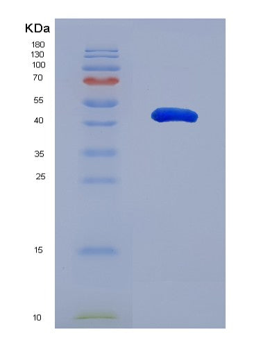 Human TINAGL1 (Tubulointerstitial Nephritis Antigen-Like) - Recombinant Protein