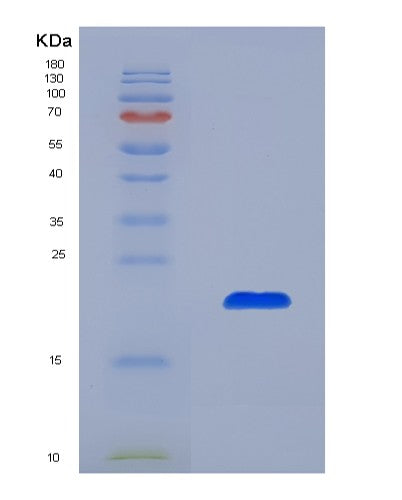 Human MAP1LC3B (Microtubule-Associated Protein 1 Light Chain 3 Beta) - Recombinant Protein