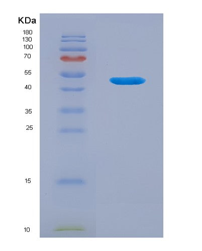 Human LACRT (Extracellular Glycoprotein Lacritin) - Recombinant Protein
