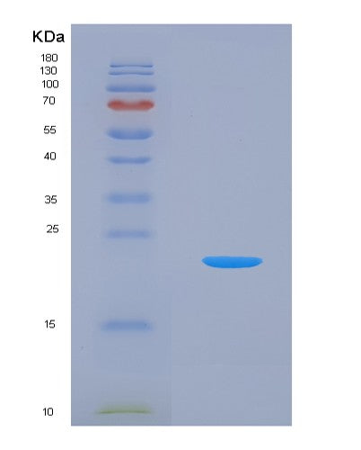 Human UBA5 (Ubiquitin-Like Modifier-Activating Enzyme 5) - Recombinant Protein