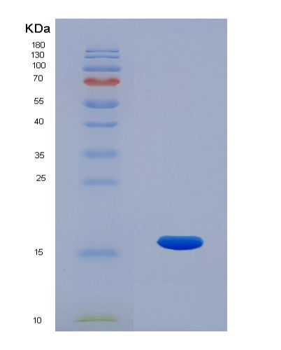 Human RNASE7 (Ribonuclease 7) - Recombinant Protein