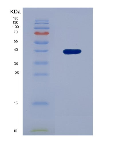Human FN3K (Fructosamine-3-Kinase) - Recombinant Protein