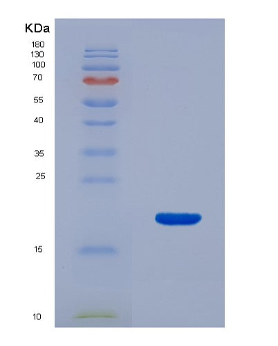 Human MAP1LC3A (Microtubule-Associated Protein 1 Light Chain 3 Alpha) - Recombinant Protein