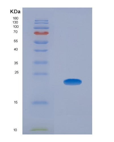 Human CLMP (Cxadr-Like Membrane Protein) - Recombinant Protein