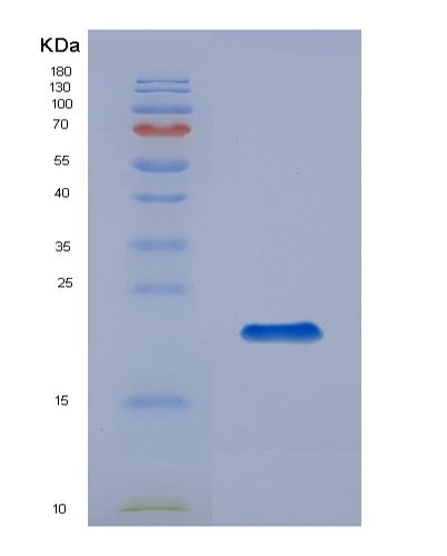 Human GREM2 (Gremlin-2) - Recombinant Protein