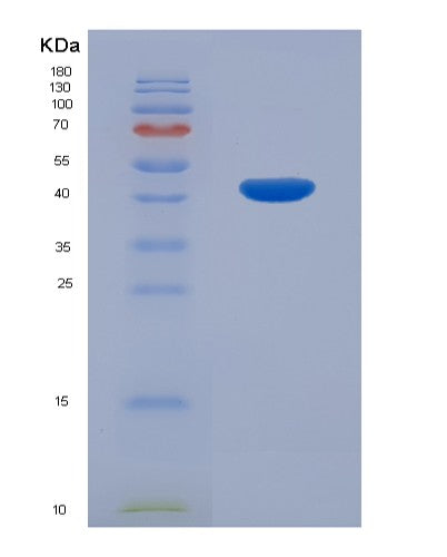 Human NHEJ1 (Non-Homologous End-Joining Factor 1) - Recombinant Protein