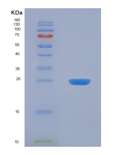 Human UCK1 (Uridine-Cytidine Kinase 1) - Recombinant Protein