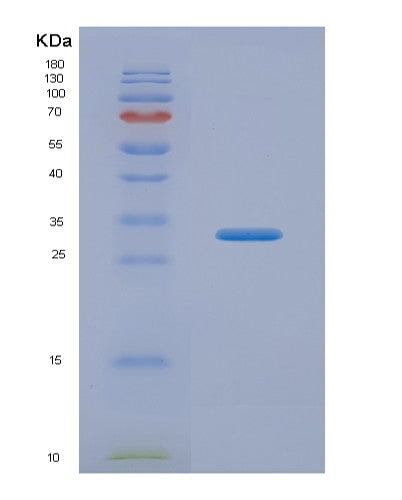 Human CACYBP (Calcyclin-Binding Protein) - Recombinant Protein