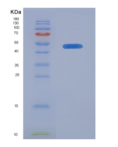 Human CRLF2 (Cytokine Receptor-Like Factor 2) - Recombinant Protein