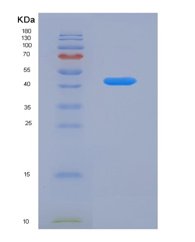 Human SRA1 (Steroid Receptor Rna Activator 1) - Recombinant Protein