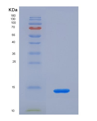 Mouse Ccl24 (C-C Motif Chemokine 24) - Recombinant Protein