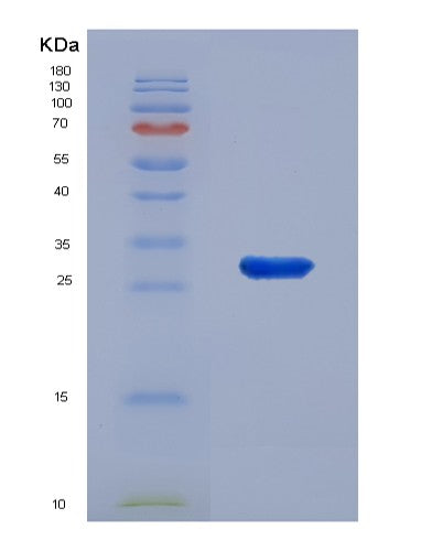 Human EXOSC4 (Exosome Complex Component Rrp41) - Recombinant Protein
