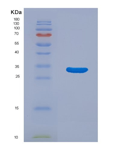 Human NRIP3 (Nuclear Receptor-Interacting Protein 3) - Recombinant Protein