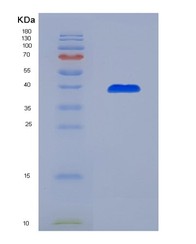 Human AASDHPPT (L-Aminoadipate-Semialdehyde Dehydrogenase-Phosphopantetheinyl Transferase) - Recombinant Protein