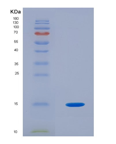 Human PHPT1 (14 Kda Phosphohistidine Phosphatase) - Recombinant Protein