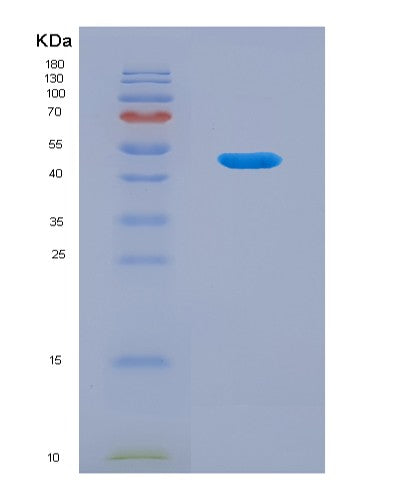 Human GKN1 (Gastrokine-1) - Recombinant Protein