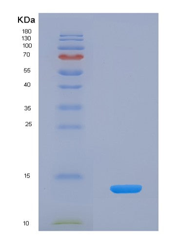 Human CTNNBIP1 (Beta-Catenin-Interacting Protein 1) - Recombinant Protein