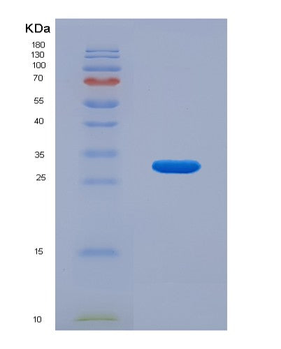 Human SIRT3 (Nad-Dependent Protein Deacetylase Sirtuin-3, Mitochondrial) - Recombinant Protein