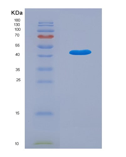 Human TBC1D13 (Tbc1 Domain Family Member 13) - Recombinant Protein