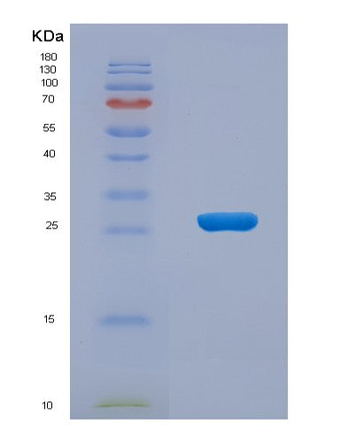Human ARL15 (Adp-Ribosylation Factor-Like Protein 15) - Recombinant Protein